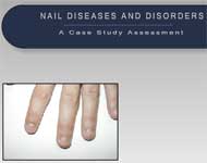 Nail Diseases and Disorders:  A Case Study Assessment