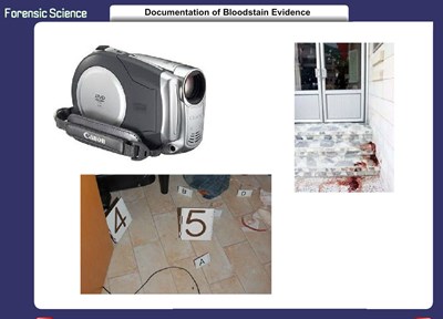 Documentation of Bloodstain Evidence (Screencast)
