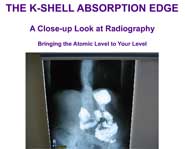 The K-Shell Absorption Edge:  A Close-Up Look at Radiography
